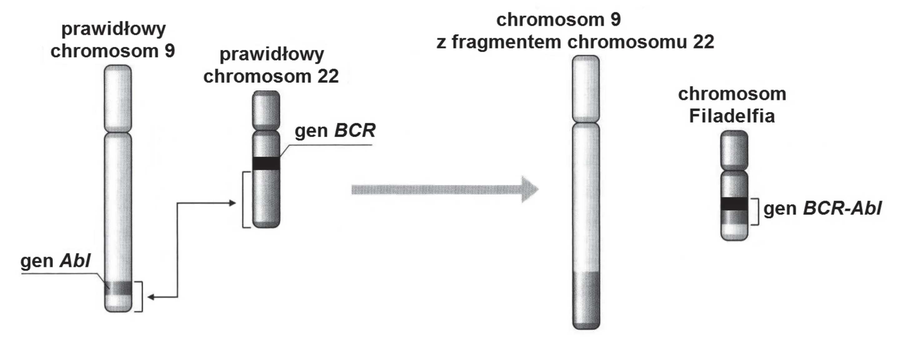 Schemat przedstawia translokację genów Abl z dłuższego chromosomu 9 i BCR z krótszego chromosomu 22. W jej wyniku powstaje krótszy chromosom Filadelfia zawierający gen BCR-Abl oraz zmieniony chromosom 9 z fragmentem chromosomu 22.